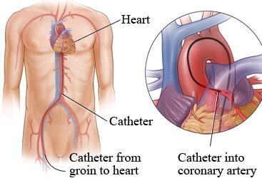 Cardiologist in Nashik | Heart Failure specialist in Nashik