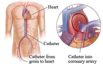 Cardiologist in Nashik | Heart Failure specialist in Nashik