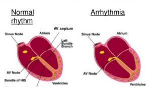 Cardiologist in Nashik | Heart Failure specialist in Nashik