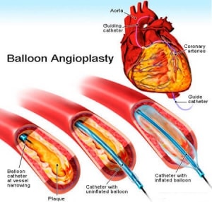 Cardiologist in Nashik | Heart Failure specialist in Nashik