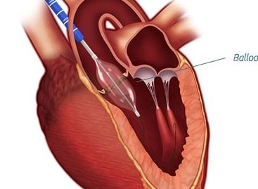 Cardiologist in Nashik | Heart Failure specialist in Nashik