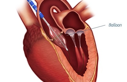 Cardiologist in Nashik | Heart Failure specialist in Nashik