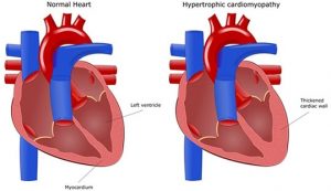 Cardiologist in Nashik | Heart Failure specialist in Nashik