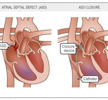 Cardiologist in Nashik | Heart Failure specialist in Nashik