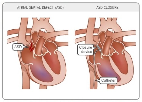 Cardiologist in Nashik | Heart Failure specialist in Nashik